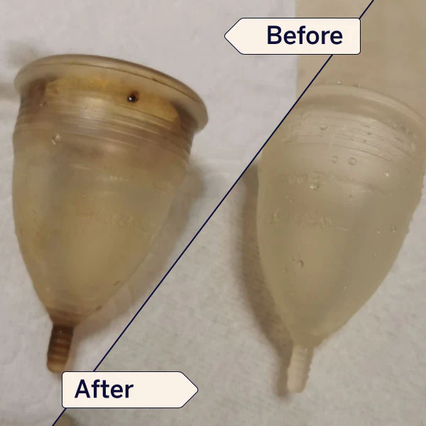 Stain Remover - Image 11