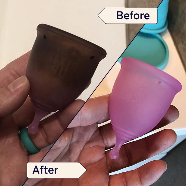Stain Remover - Image 8