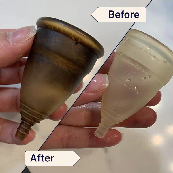 Stain Remover - Image 9
